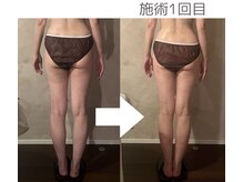 しっかり老廃物を流す！結果が出るビューティリンパマッサージ