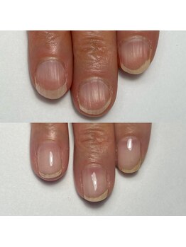 オリ ネイル(Oli_nail)/