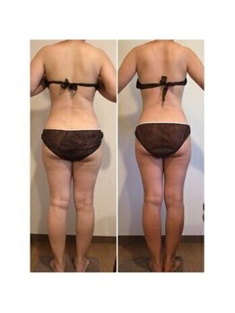 ココラーレ(cocorare)/痩身/日暮里/荒川区エステサロン