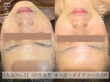 ディレイア ザ コスメ 有楽町マルイ店(direia the cosme)/たるみ/リフト/くすみ［有楽町］