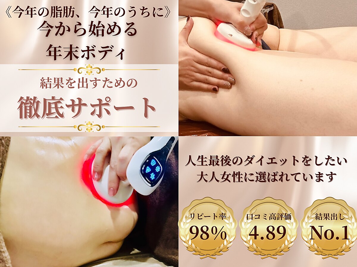 ベルホワイト(Belle White)｜ホットペッパービューティー
