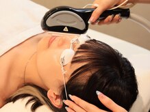 アルテ(ARTE)/6 施術後