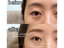 アイラッシュサロン ブラン イオンモールとなみ店(Eyelash Salon Blanc)/眉毛スタイリング×まつげパーマ