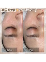 ホワイトアクア 錦糸町店(WHITE AQUA)/ララピール/東京/錦糸町