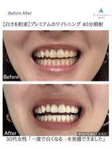 プラチナムビューティー 横須賀店/ビフォーアフター