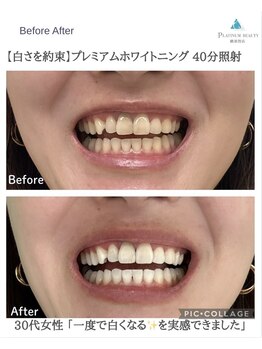 プラチナムビューティー 横須賀店/ビフォーアフター