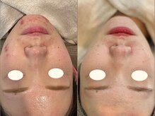 ミヨン(miyong)/韓国LDMAqua★