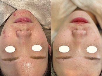 ミヨン(miyong)/韓国LDMAqua★