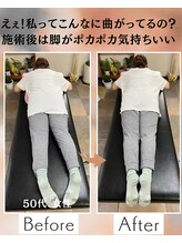 ウェルビーイング整体院 水戸赤塚店(wellbeing整体院)/Before After