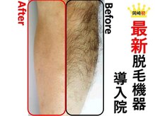 ゴールデンケア 岡崎店の雰囲気(岡崎初の最新機器で圧倒的な効果(メンズ脱毛/顔脱毛/全身脱毛))