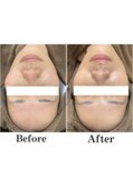 フォルチェ ゆめタウン広島店(Folche)/TIP化粧品取扱店