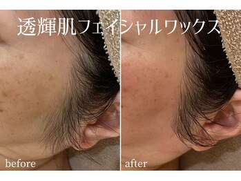 ハティア(hattia)/産毛と一緒に角質ケア！透明感UP