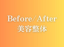 ルルラボ(LuLu beauty labo)/Before/After小顔矯正