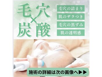 ルーセント/
