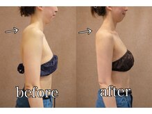 きぃ オリジンプラス(きぃ origin+)/施術後の変化