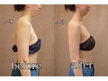 きぃ オリジンプラス(きぃ origin+)/施術後の変化