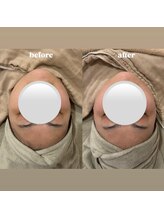 &still【アンドスティル】【4/1 NEW OPEN（予定）】 /【小顔コルギ】