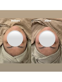 &still【アンドスティル】【4/1 NEW OPEN(予定)】 /【小顔コルギ】