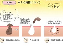 サロン ド リー 輪之内店(Salon de Re+)/毛穴のお掃除