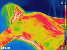 美人バスト 福岡店/マシーン施術後の冷え改善→→→