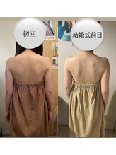 カシェット(cachette)/ブライダルエステ