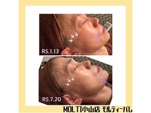 モルティーパレ(Molti Palais)/