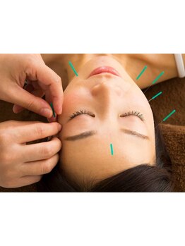 鍼灸施術を受けたい