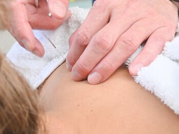 オーシャン鍼灸院の写真/原因不明の不調や不眠に…自律神経の乱れが気になる方へ、身体の芯から整える本格鍼灸をご提案します☆