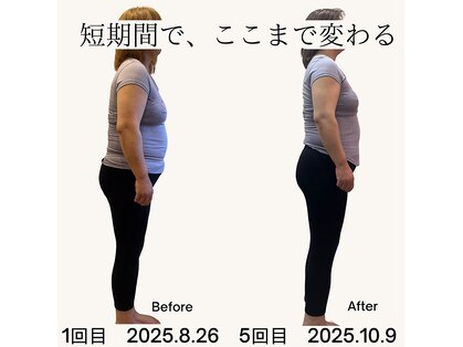 リマ(LIMA)の写真