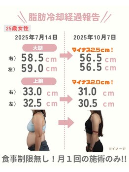 ココ(Coco)/気になる皮下脂肪にアプローチ