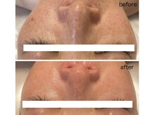 リリーココ(Lily Coco)の雰囲気（最新連射式光フォト×ララピール）