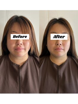 黒田鍼灸治療院/姿勢と小顔フェイスライン