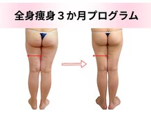 エルナ(Eluna)/本格痩身105分コース