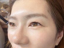 ユニ(uni)の雰囲気（アンドヘルシー100本）