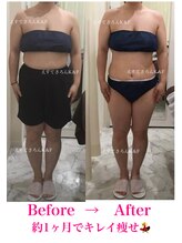 えすてさろん ケイアンドエフ(k&f)/施術結果5回/30代