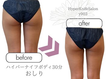 ワイキューマルサン(y903)/ハイパーナイフボディ60分下半身