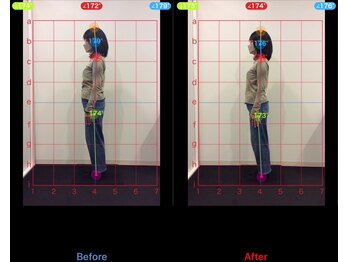 ケアルーム 茅ヶ崎(CAREroom)/施術効果写真☆(before after)