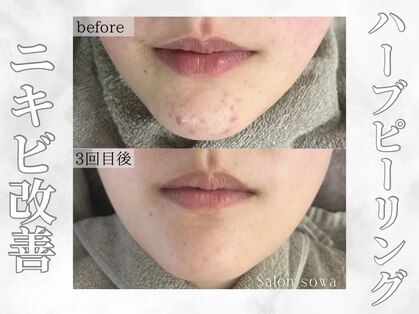 サロンソワ(salon 想和)の写真