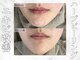 サロンソワ(salon 想和)の写真