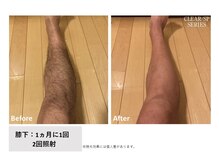 ル リアン(Le Lien)の雰囲気（女性はもちろん◎男性のボディ脱毛も増えてます◎）