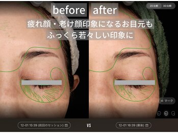 ダイヤモンドトゥルース(Diamond truth)/目元のシワ予防と改善に