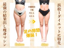 ベベティー(BEBETIE)