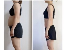 時空箱(ときのはこ)/【3か月/６回施術後】