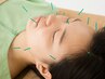 【NEW】しわ たるみ えら ほうれい線　美容鍼×小顔×リンパ◆60分7700円→