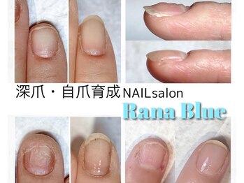 ラーナ ブルー(Rana Blue)