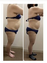 エアリアル 八代店/脂肪冷却の変化！