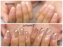 ウィズネイル(Wiznail)