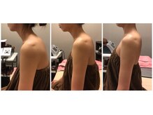 エステティック リオン(Rion)/ビフォーアフター