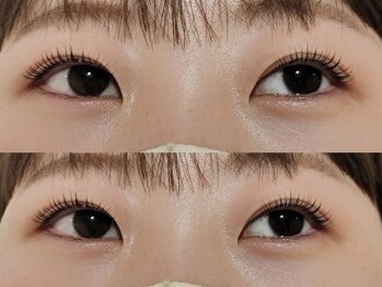 アーリア 阿佐ヶ谷店(arya)/まつ毛パーマ/ラッシュリフト