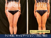 エヴァーグレース 宇都宮店/お悩みをしっかりお聞きしてから
